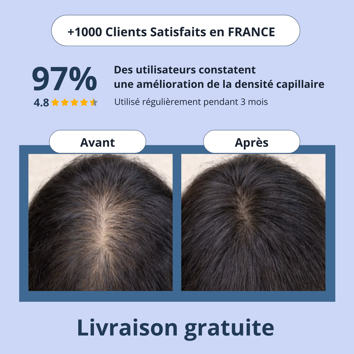 Sérum Densifiant Cheveux – Anti-Chute & Croissance