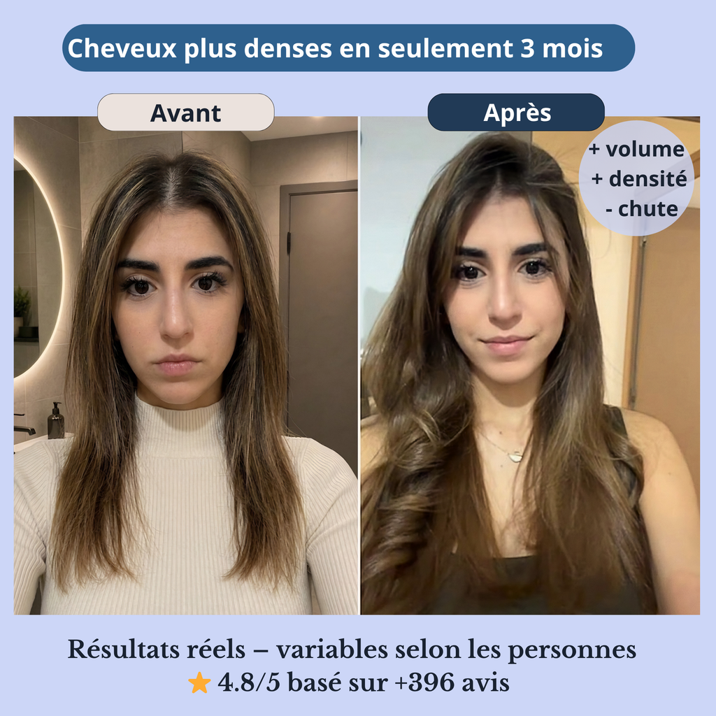 Sérum Densifiant Cheveux – Anti-Chute & Croissance